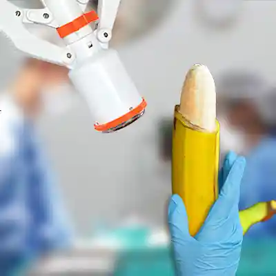 Stapler Circumcision